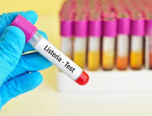 Use of a Fluorogenic Probe in a PCR-Based Assay for the Detection of Listeria monocytogenes